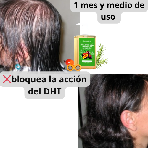 Shampoo con aceite de batana: fuerza, brillo y resultados reales + envío gratis